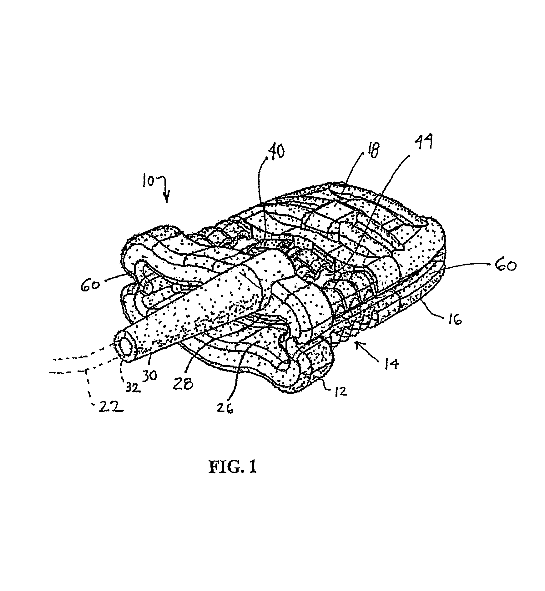 Sensor assembly