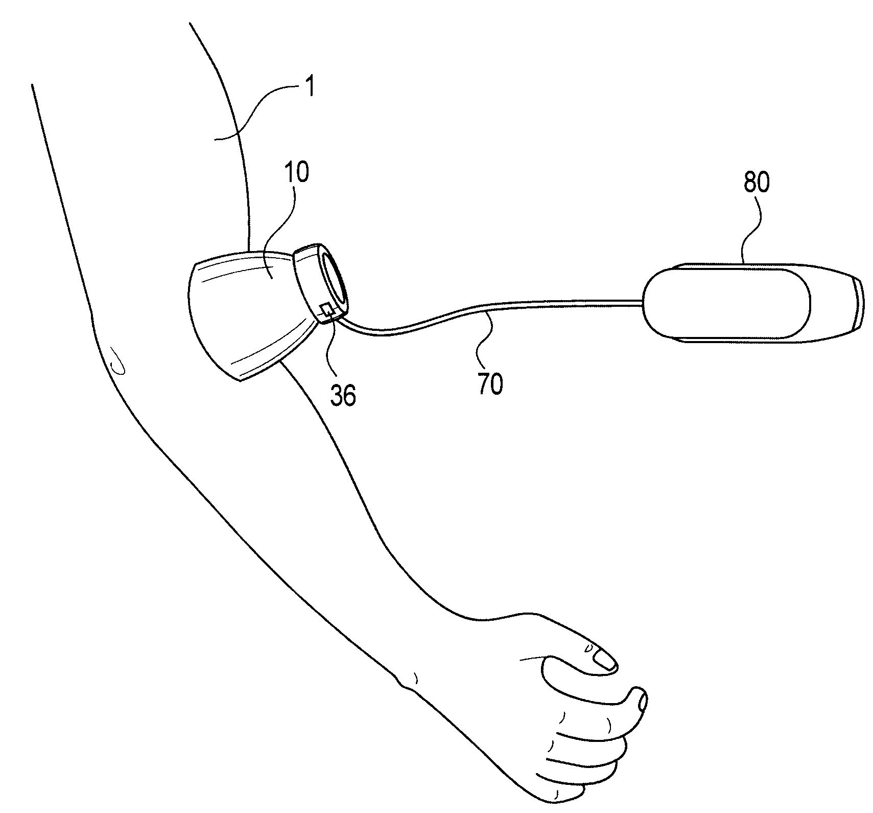 Therapeutic emitter retaining device