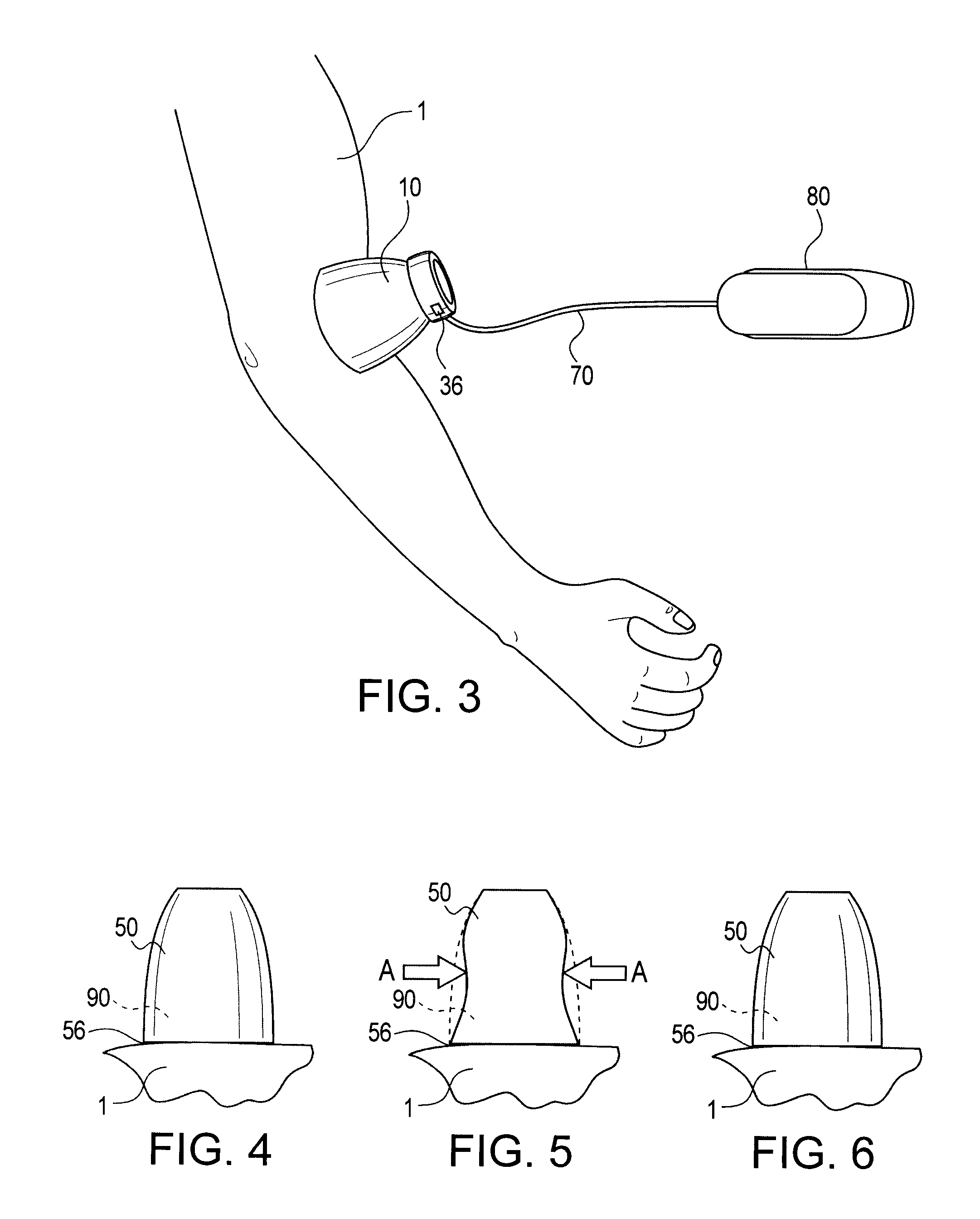 Therapeutic emitter retaining device