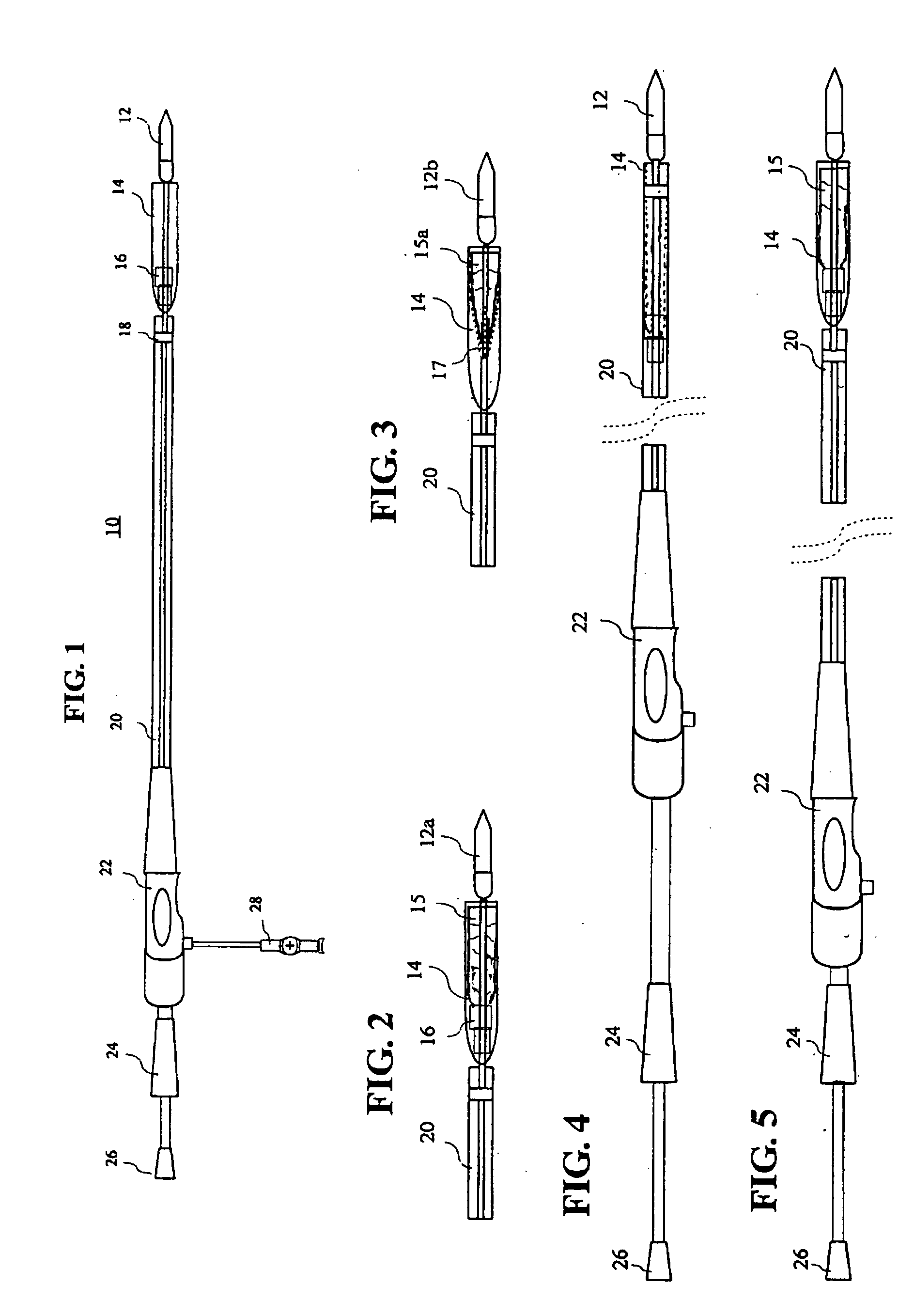 Double sheath deployment system