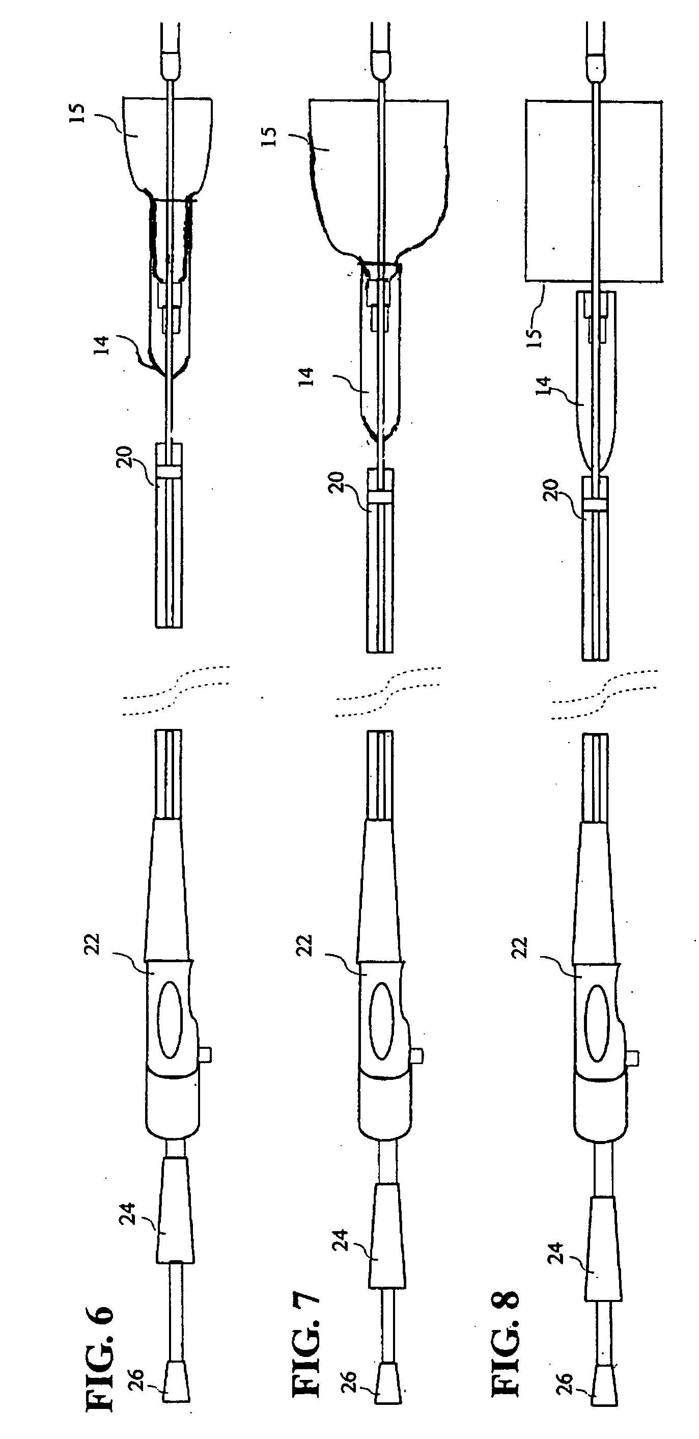 Double sheath deployment system