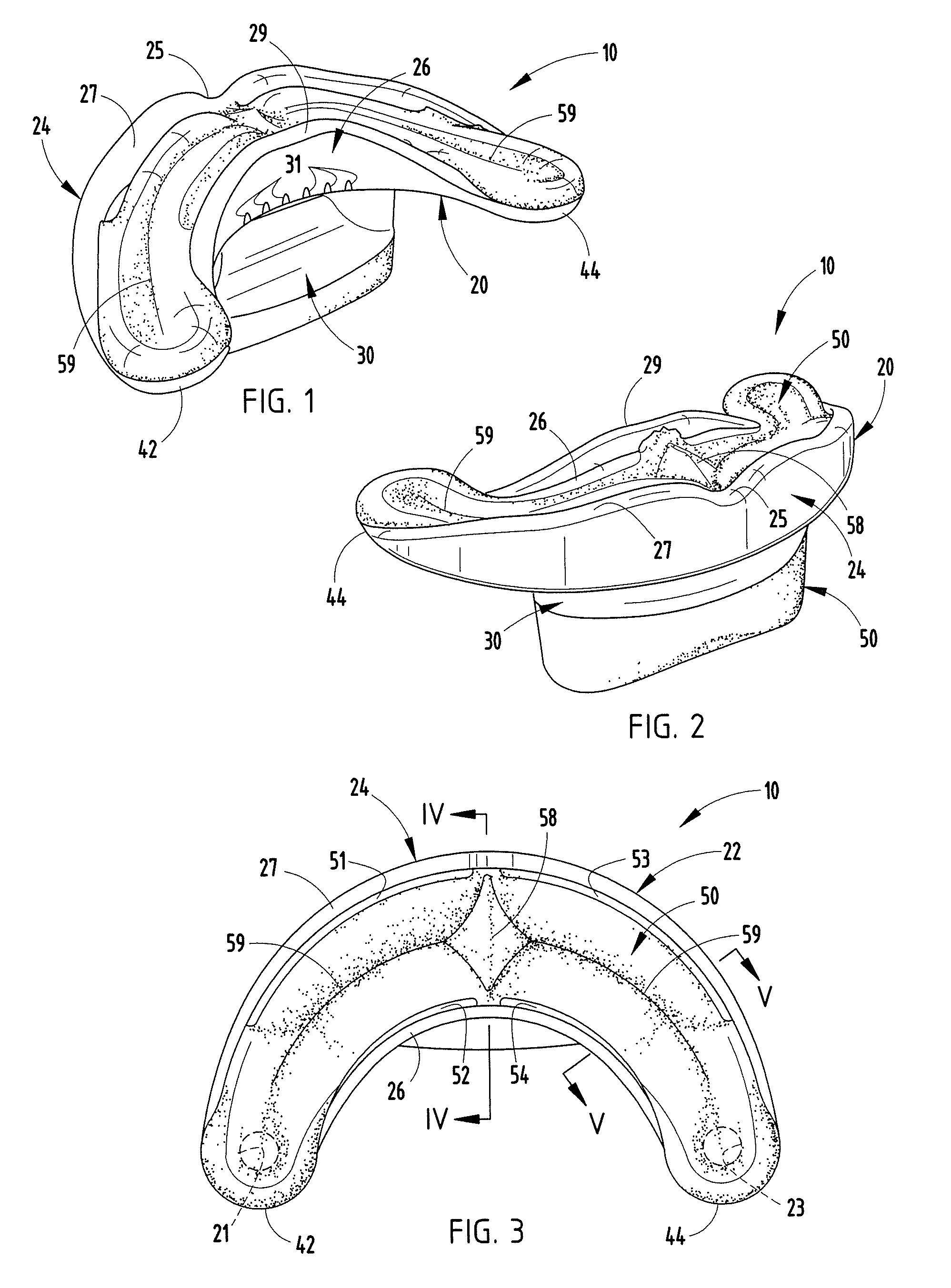 Oral orthosis