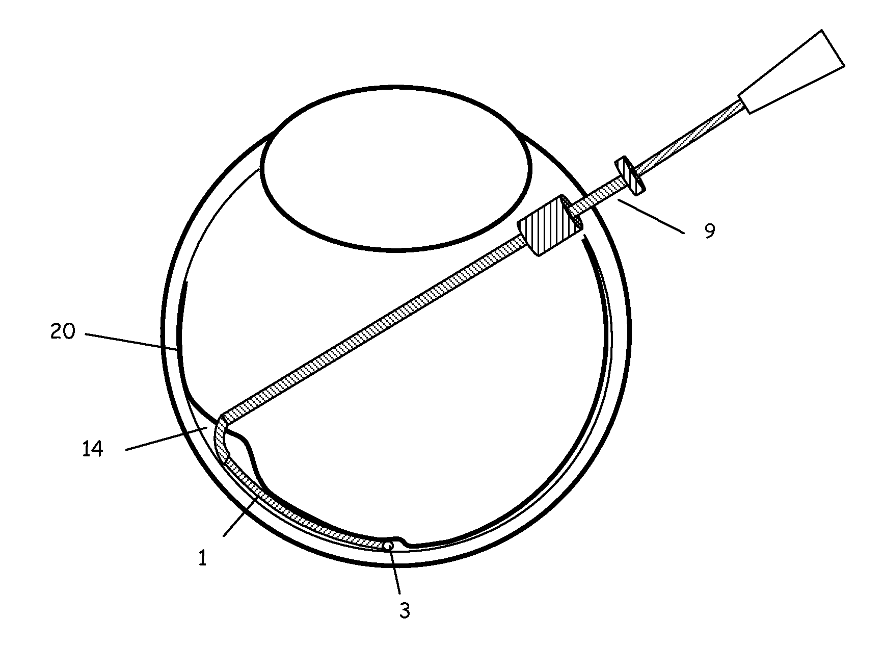 Methods and apparatus for sub-retinal catheterization