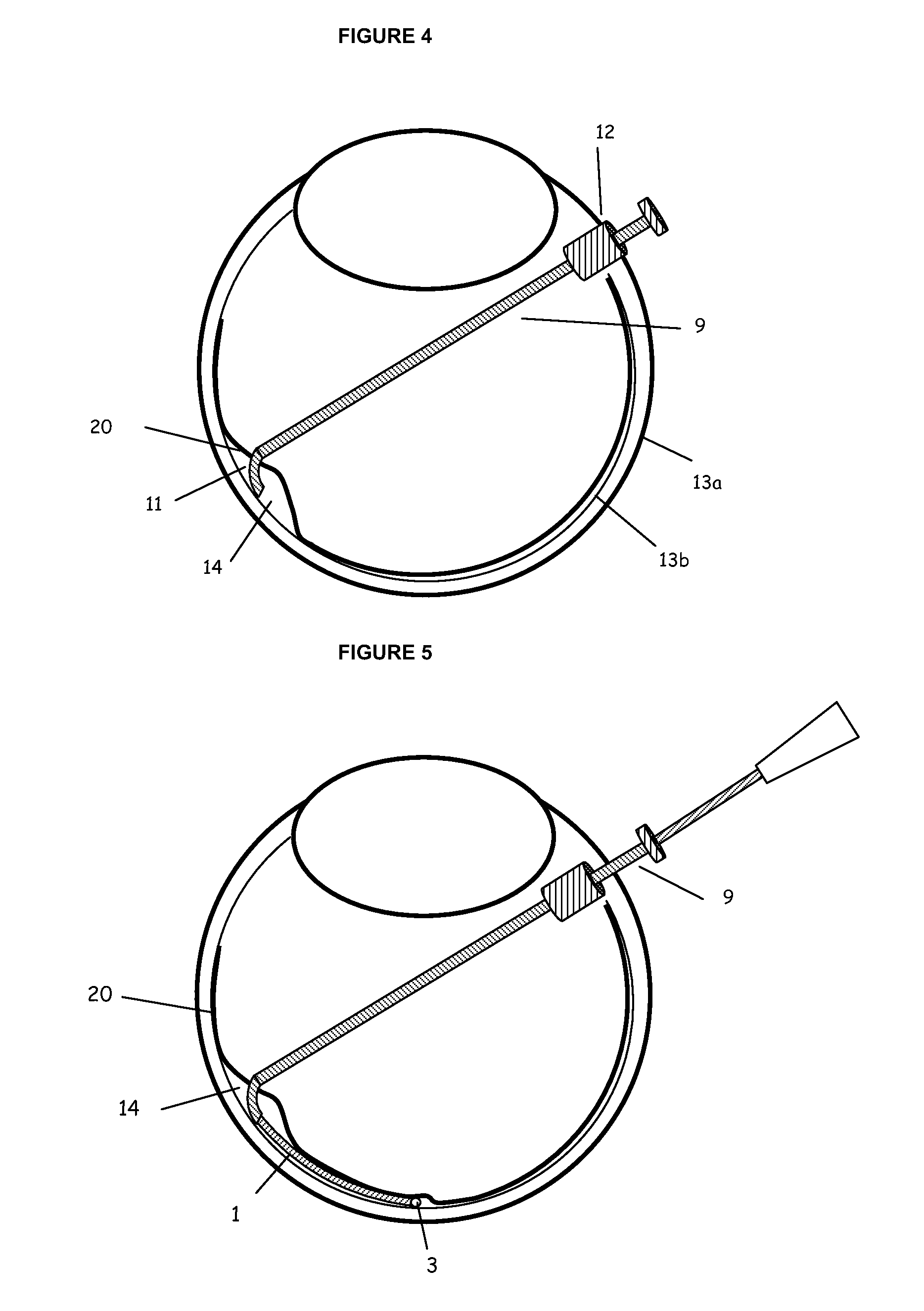 Methods and apparatus for sub-retinal catheterization