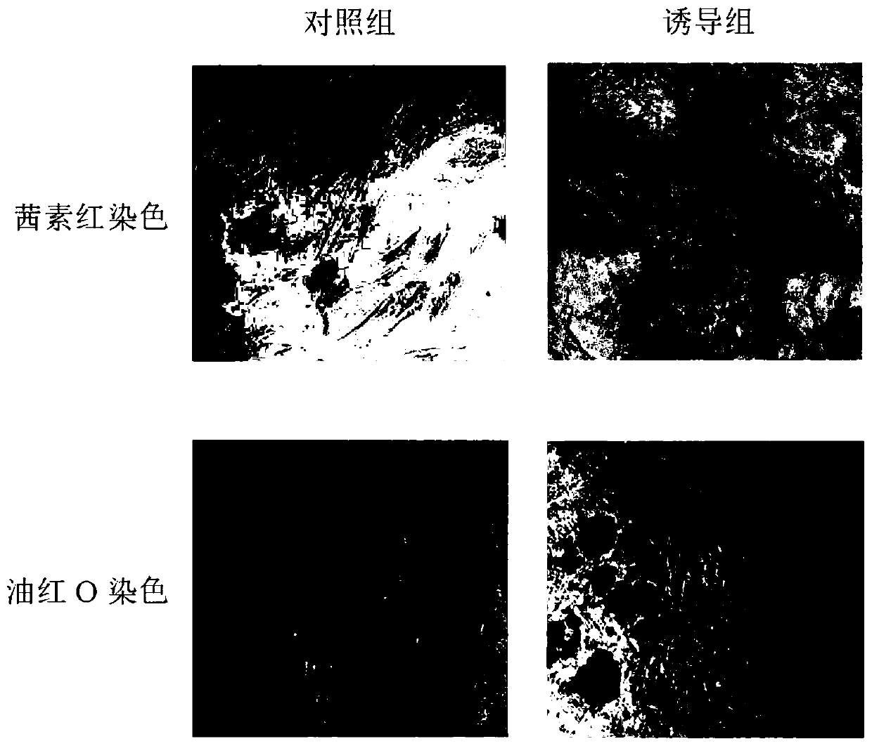 Application of serum thymus factor in promoting proliferation of human amniotic mesenchymal stem cells in vitro and preparing proliferation culture medium