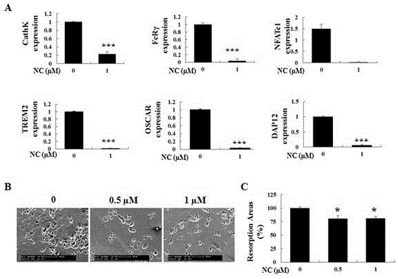 Application of nitidine chloride in preparing medicines for resisting osteoporosis and bone loss diseases