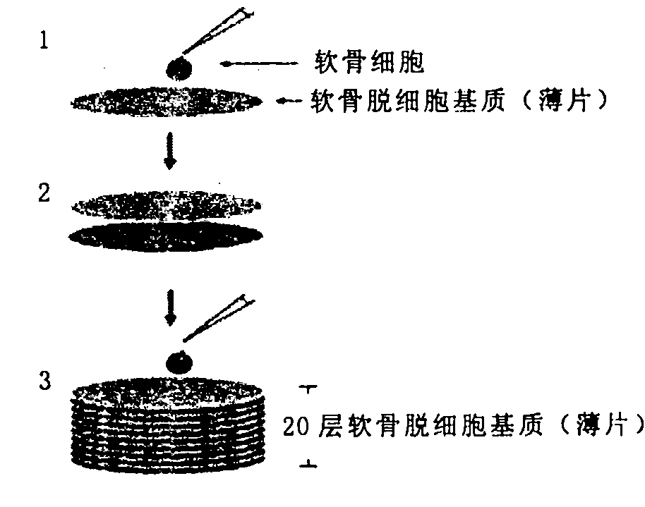 Cartilage cell removal matrix and preparation method and application thereof