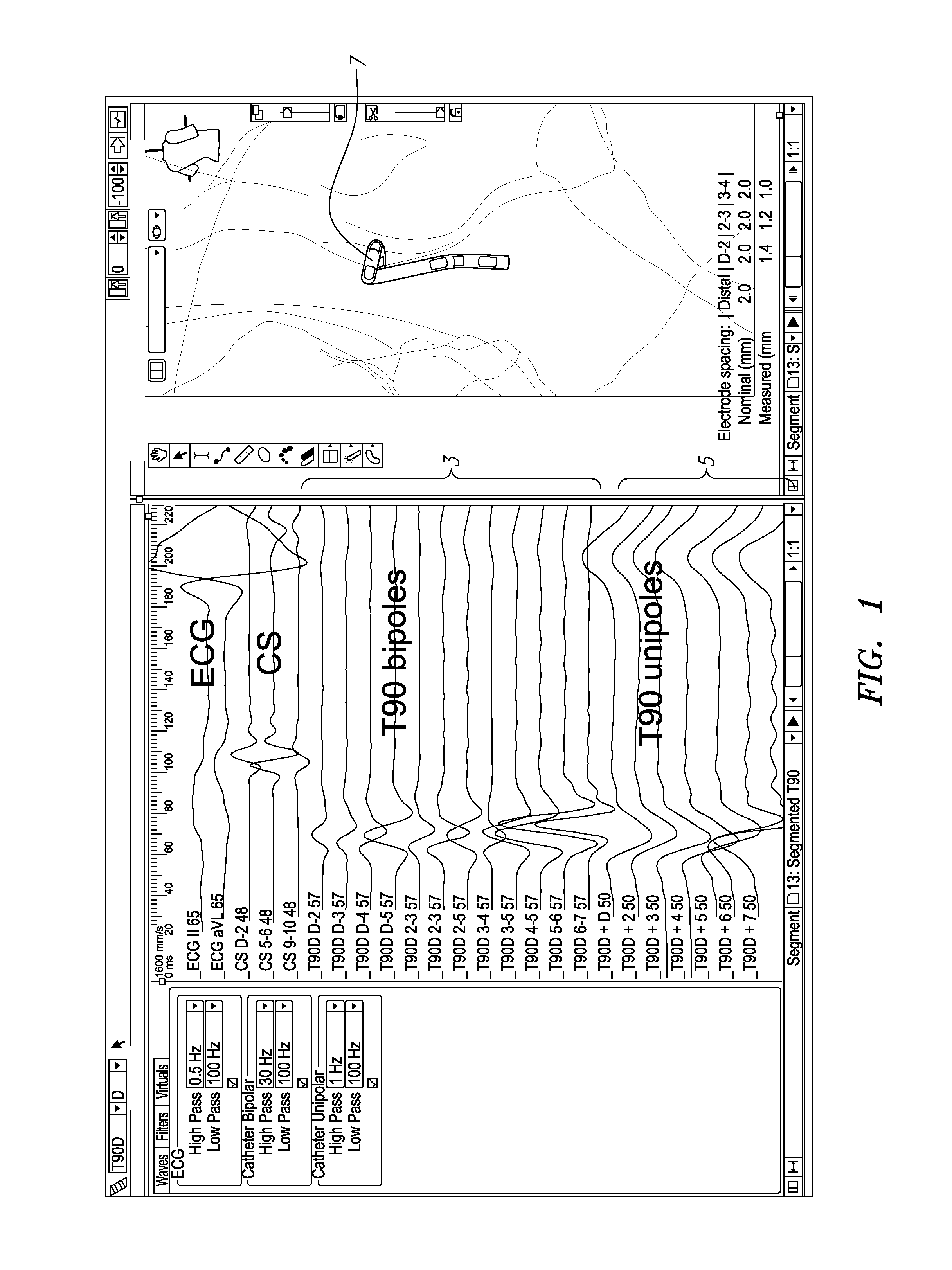 System and method for local electrophysiological characterization of cardiac substrate using multi-electrode catheters