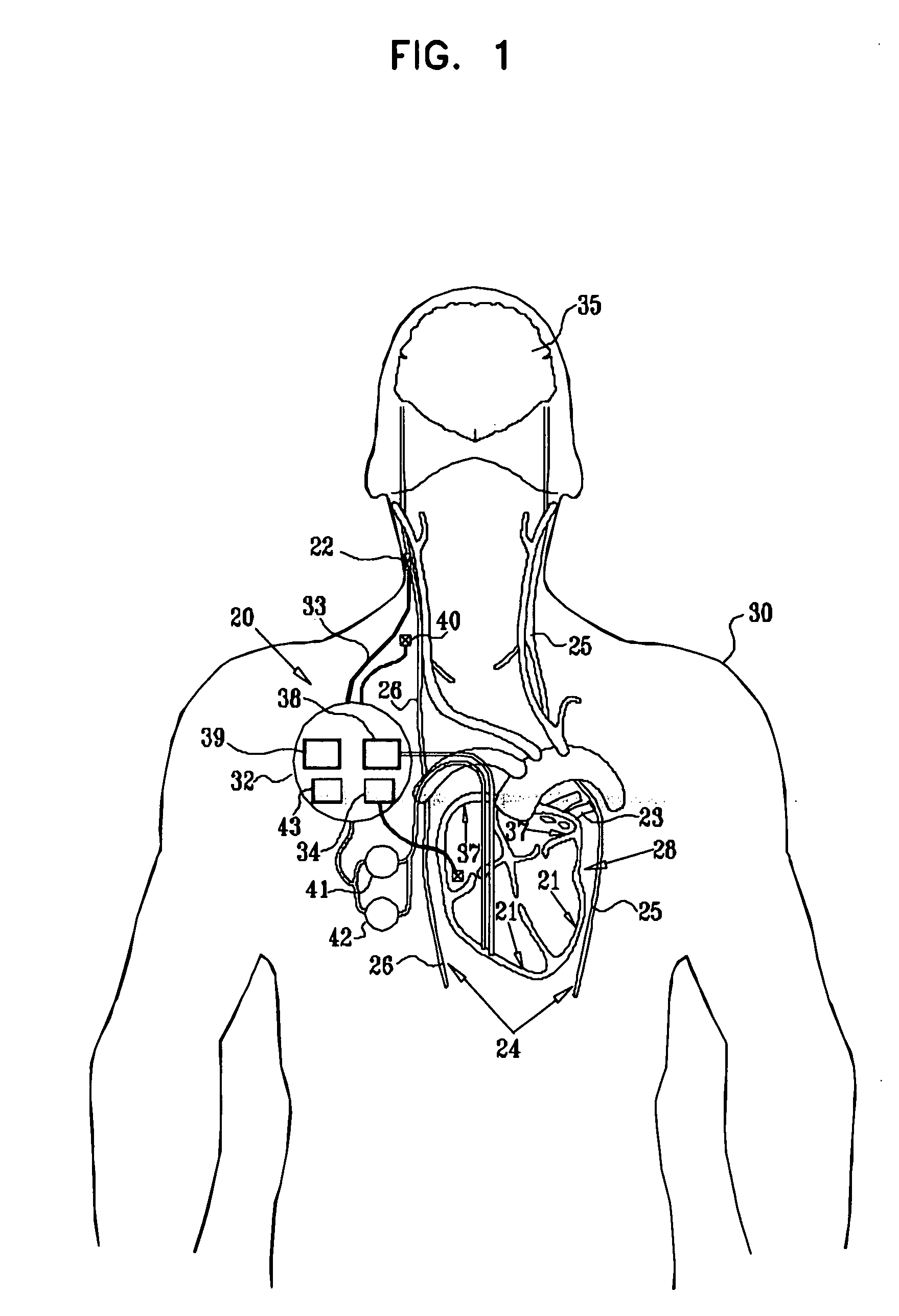 Combined parasympathetic stimulation and cardiac pacing