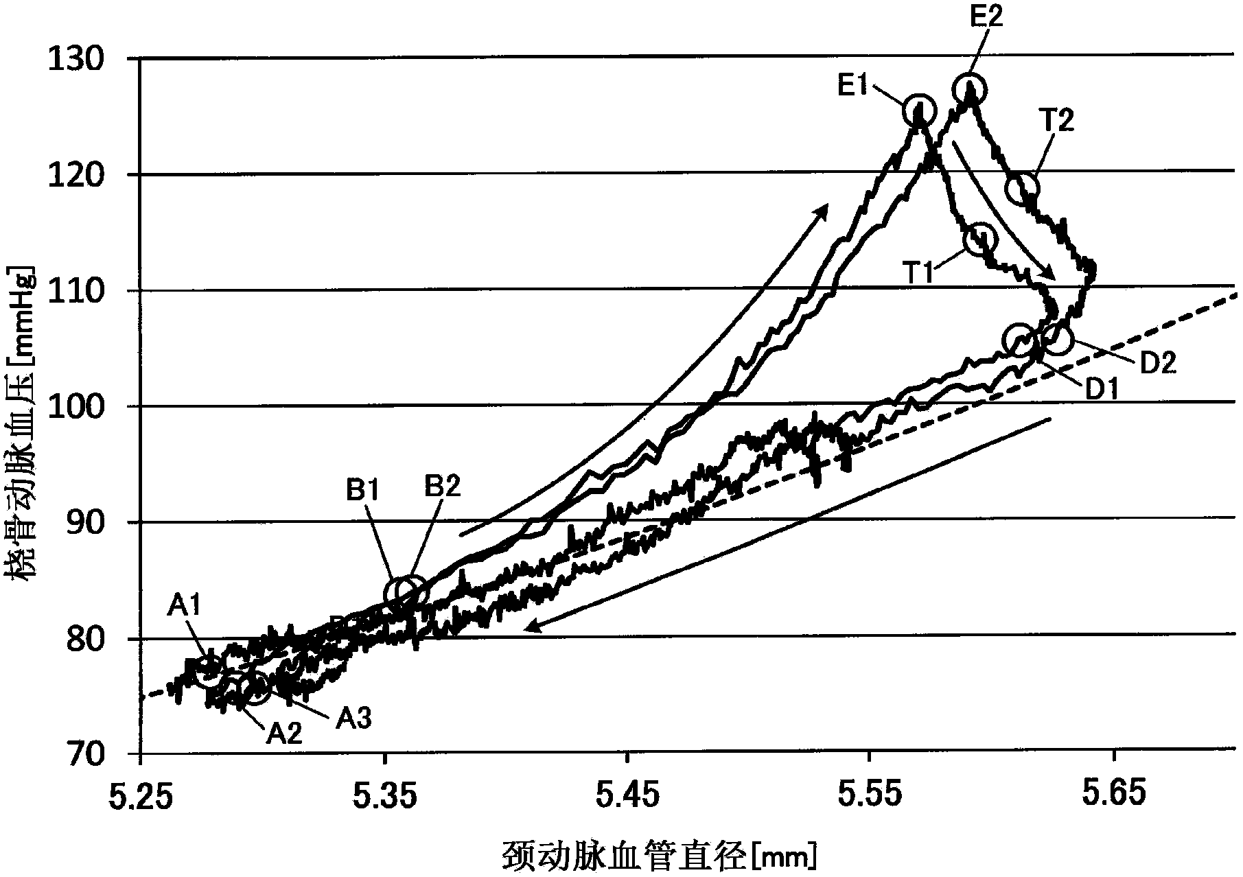 Blood pressure measuring apparatus and method for calibrating central blood pressure estimation parameter