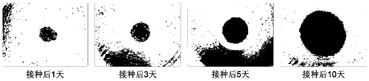 Specific culture medium for lung tumor organ and stentless 3D culturing method