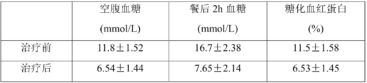 Composite traditional Chinese medicine dropping pill for treating type-II diabetes and preparation method of composite traditional Chinese medicine dropping pill