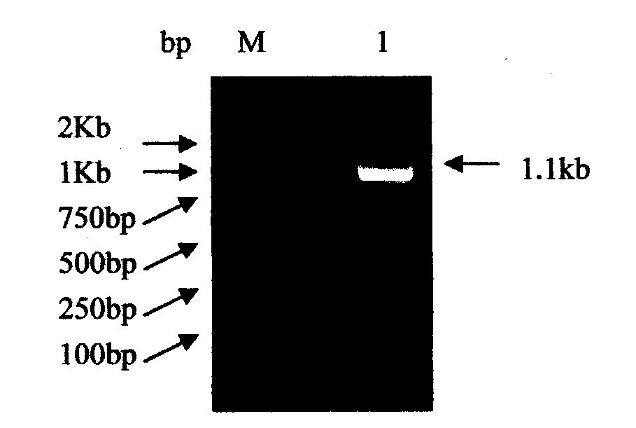 Corynebacterium glutmicum synthase gene cloning and L183Q site directed mutagenesis method