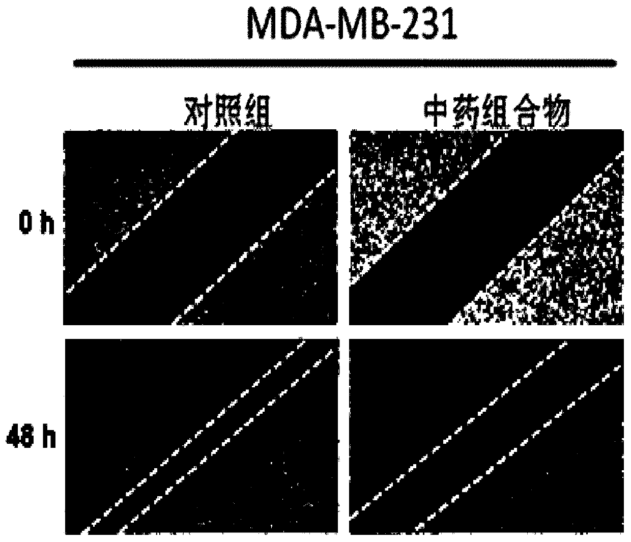 Traditional Chinese medicine composition capable of inhibiting tumor metastasis and preparation method and application thereof