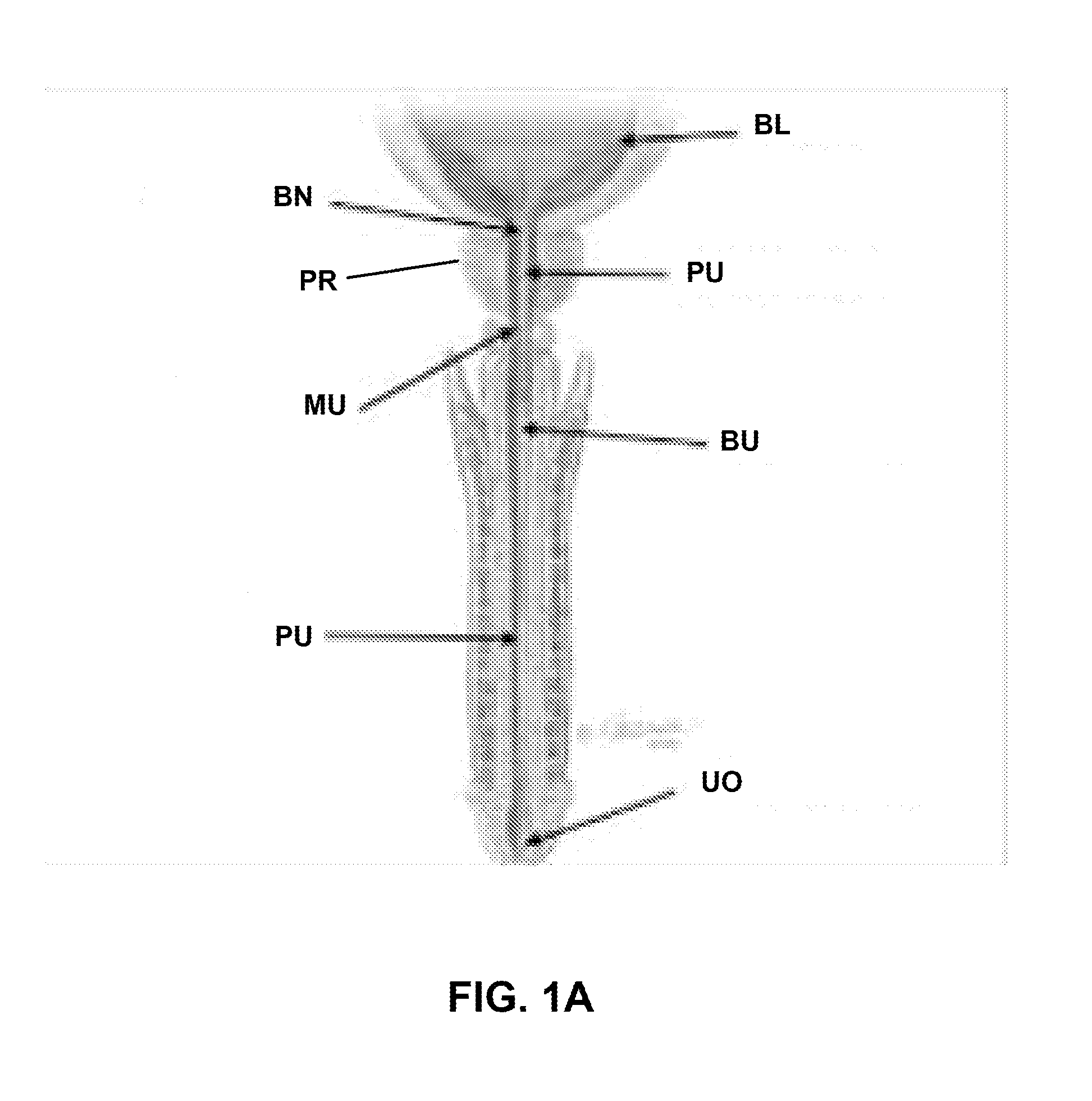 Indwelling body lumen expander