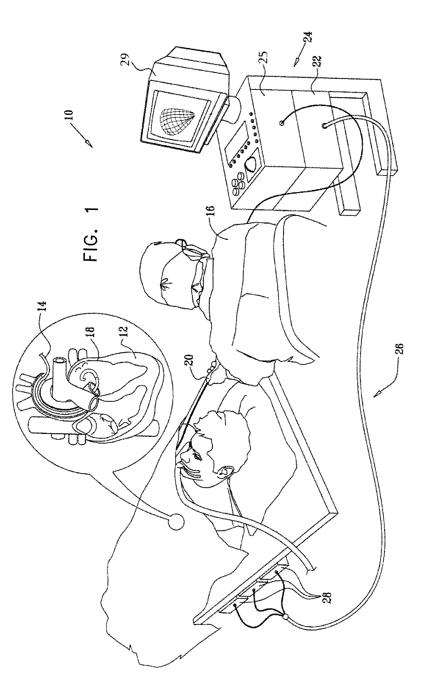 Dual-purpose lasso catheter with irrigation using circumferentially arranged ring bump electrodes