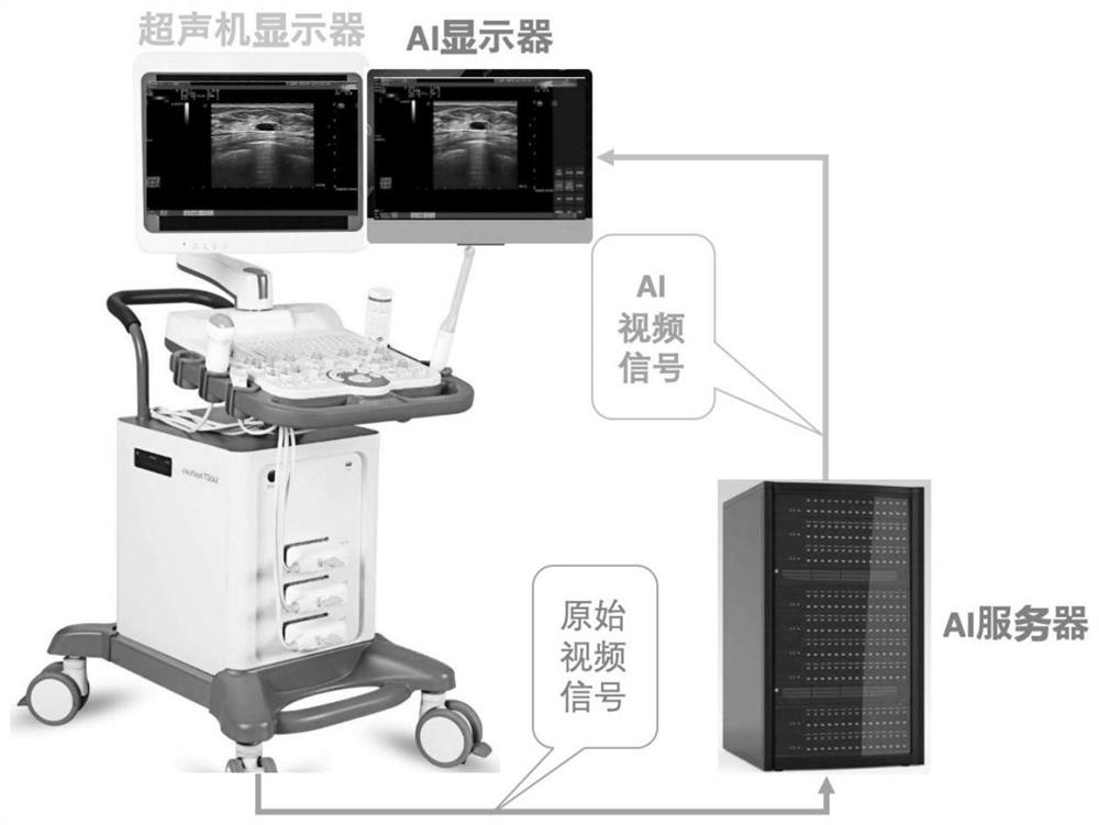 A device, system, and image processing method for real-time detection and segmentation of whole lesions in dynamic breast ultrasound video based on artificial intelligence