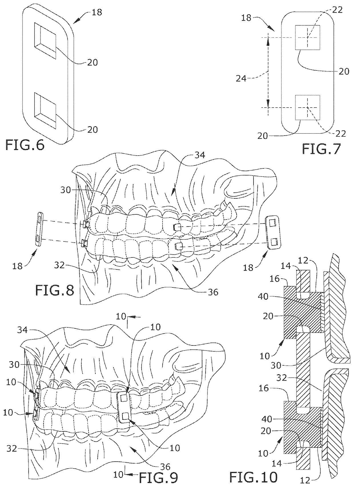 Apparatus and methods to convert dental, oral, orthodontic appliances, retainers, and dentures into a multifunctional oral appliance