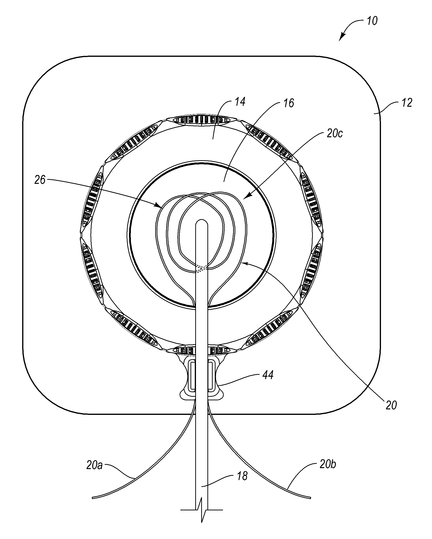 Self-suturing anchor device