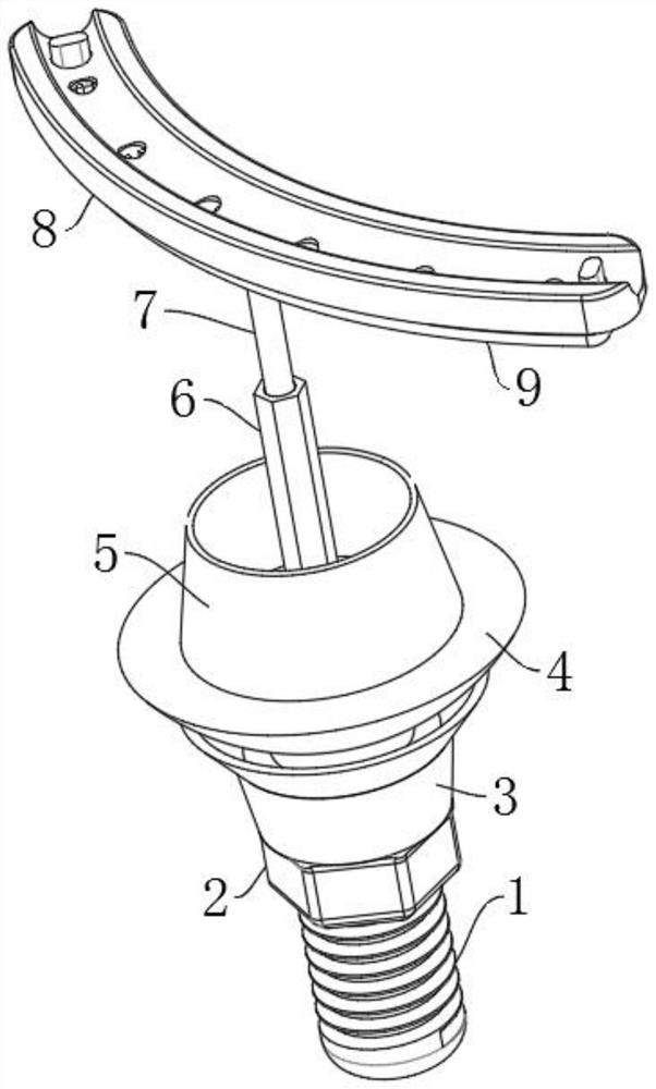 Adjustable universal composite abutment made of biomedical material and used for dental implant