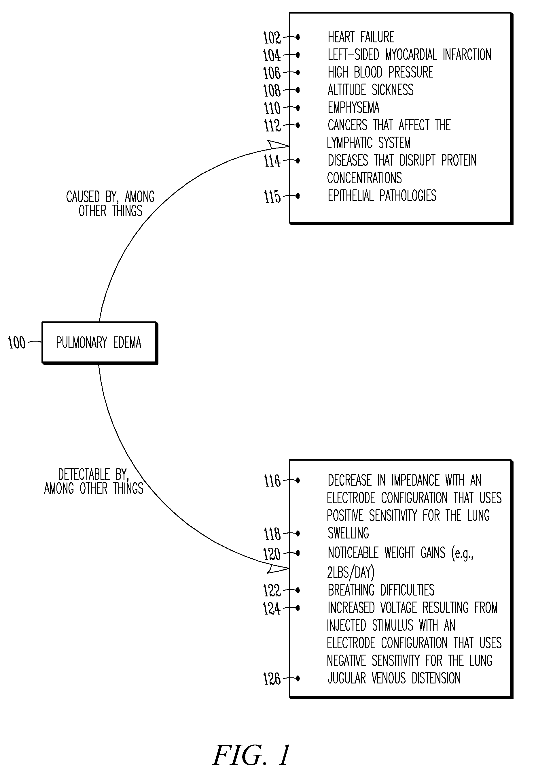 Monitoring fluid in a subject using an electrode configuration providing negative sensitivity regions