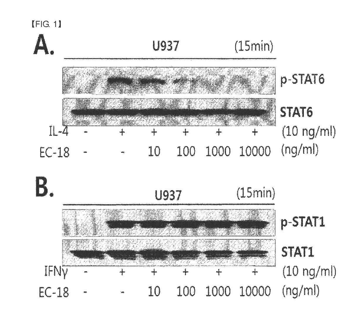 Composition containing monoacetyldiacylglycerol compound as active ingredient for inhibiting blood cancer or metastasis