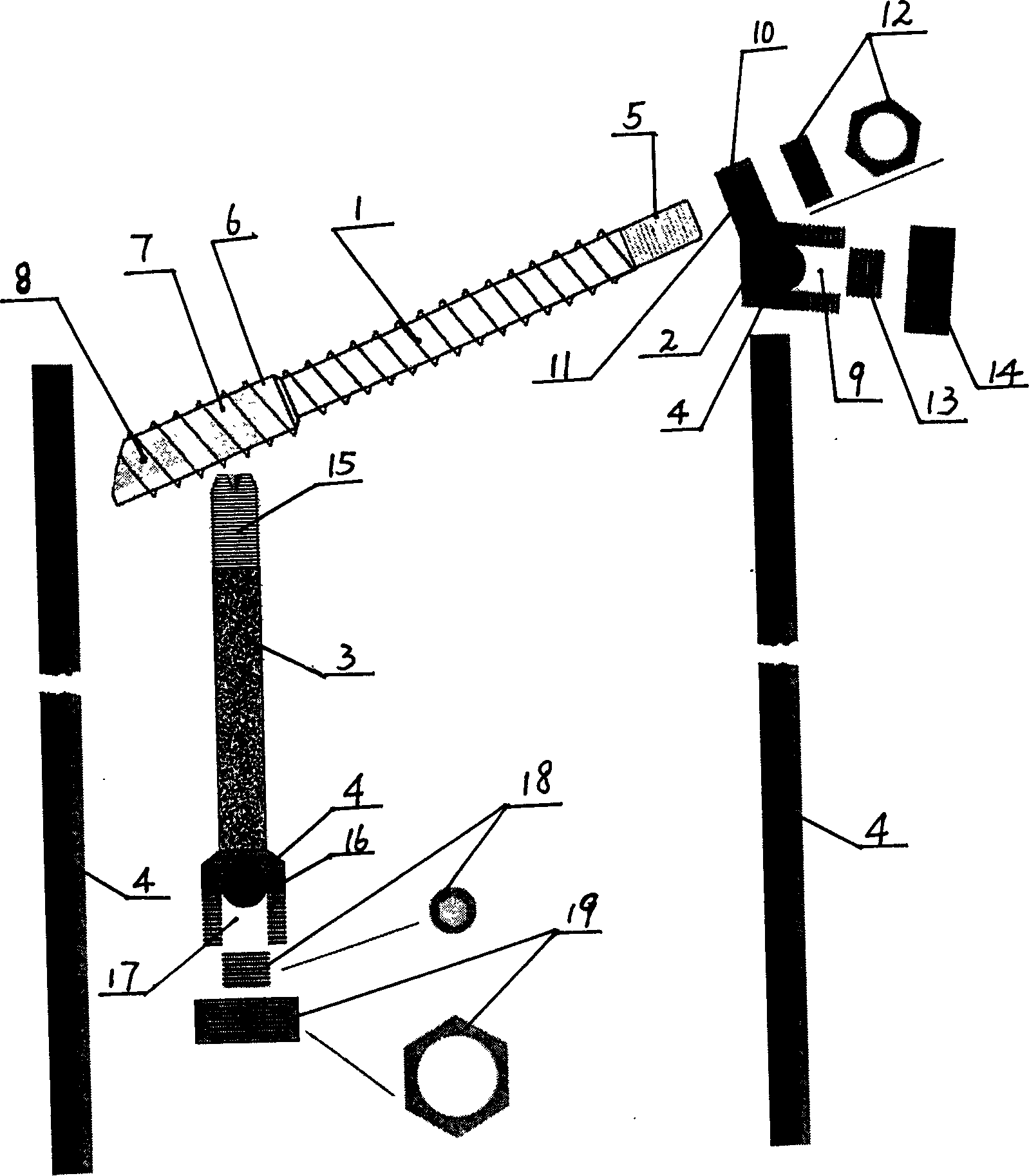 Front and rear combined scoliosis correcting system through pedicle of vertebral arch