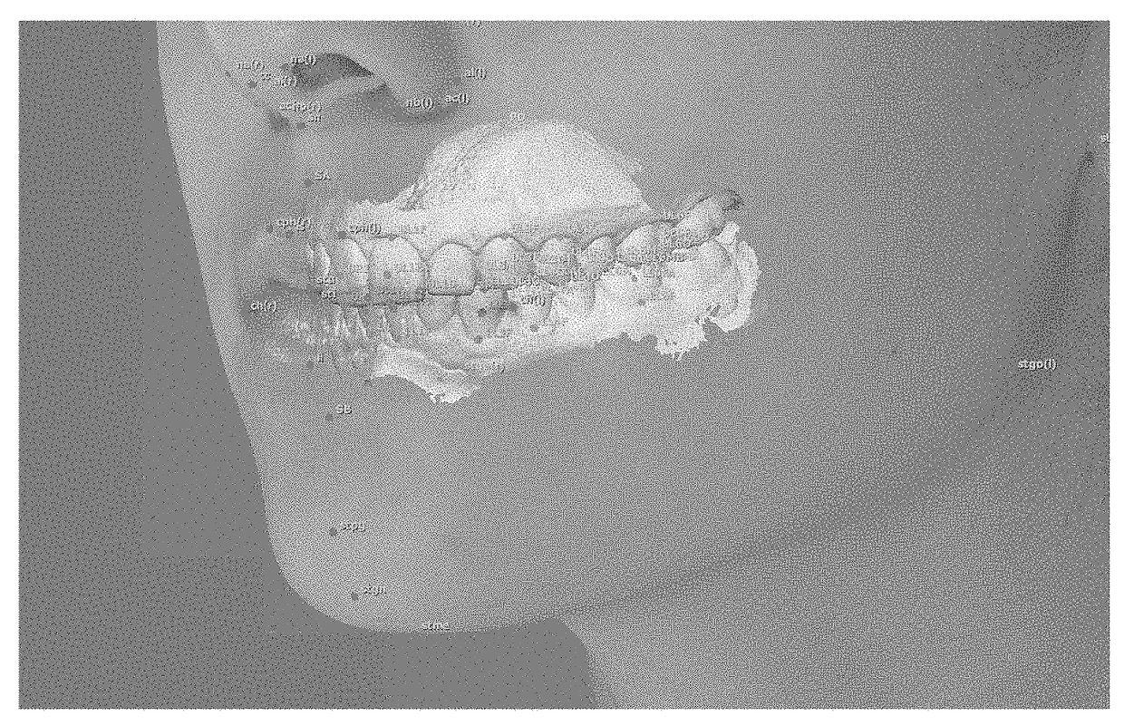 3D dentofacial system and method