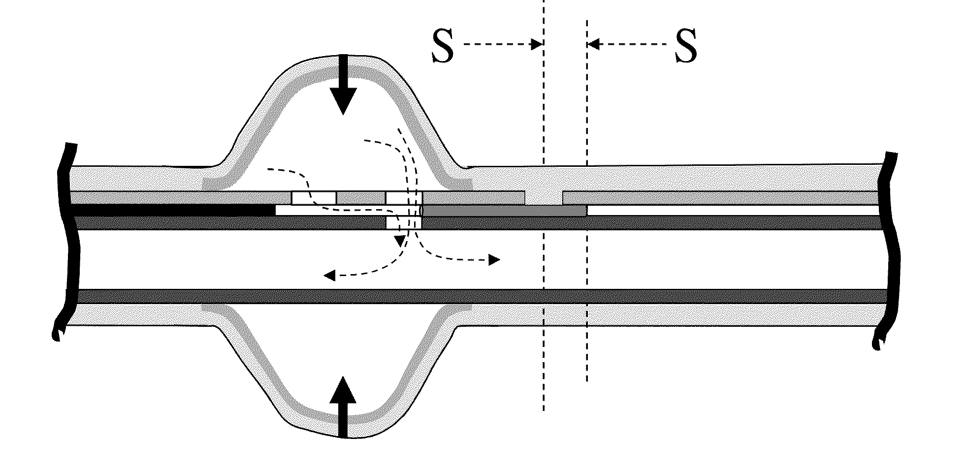 Stretch Valve Balloon Catheter and Methods for Producing and Using Same