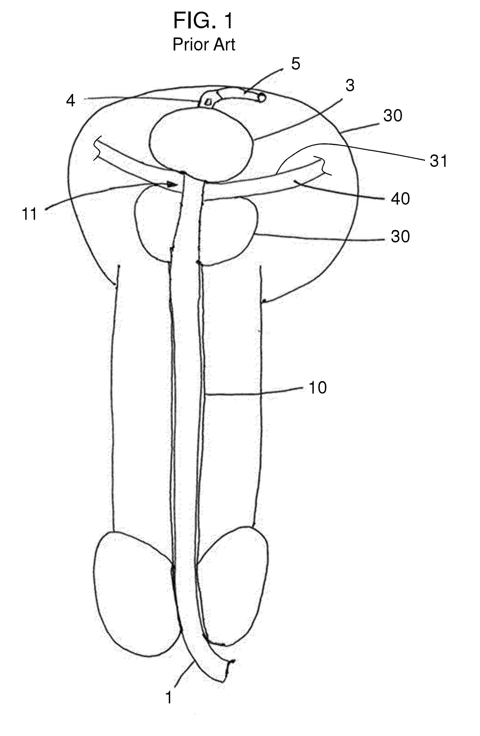 Stretch Valve Balloon Catheter and Methods for Producing and Using Same