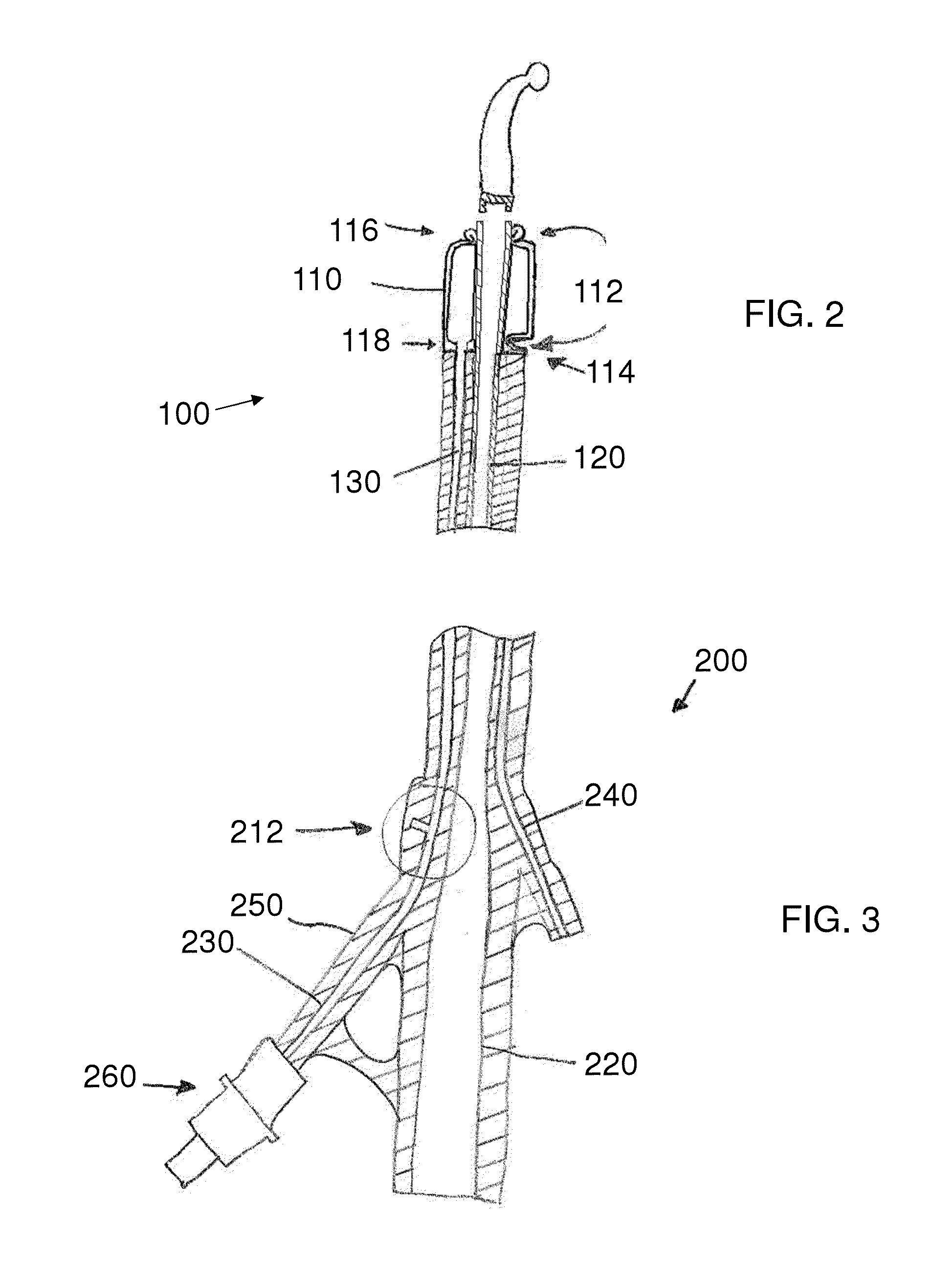 Stretch Valve Balloon Catheter and Methods for Producing and Using Same