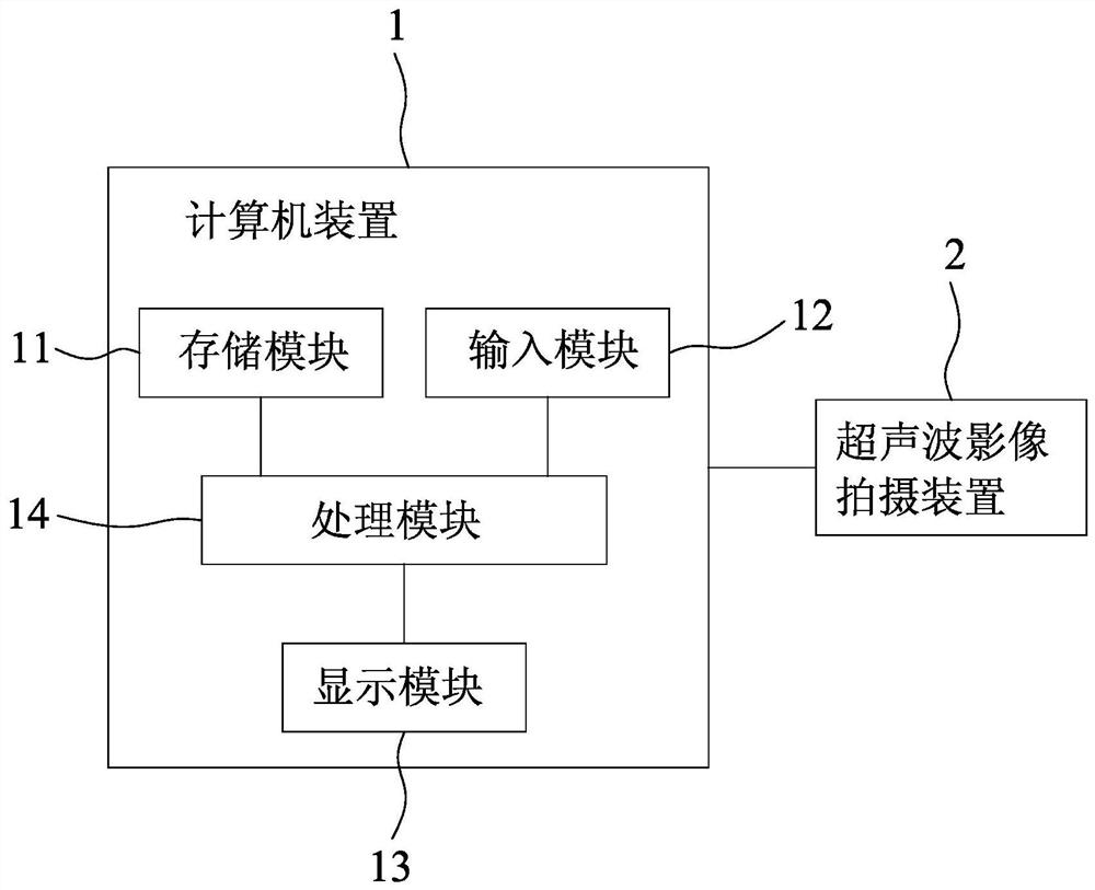 Medical Image Alignment Method