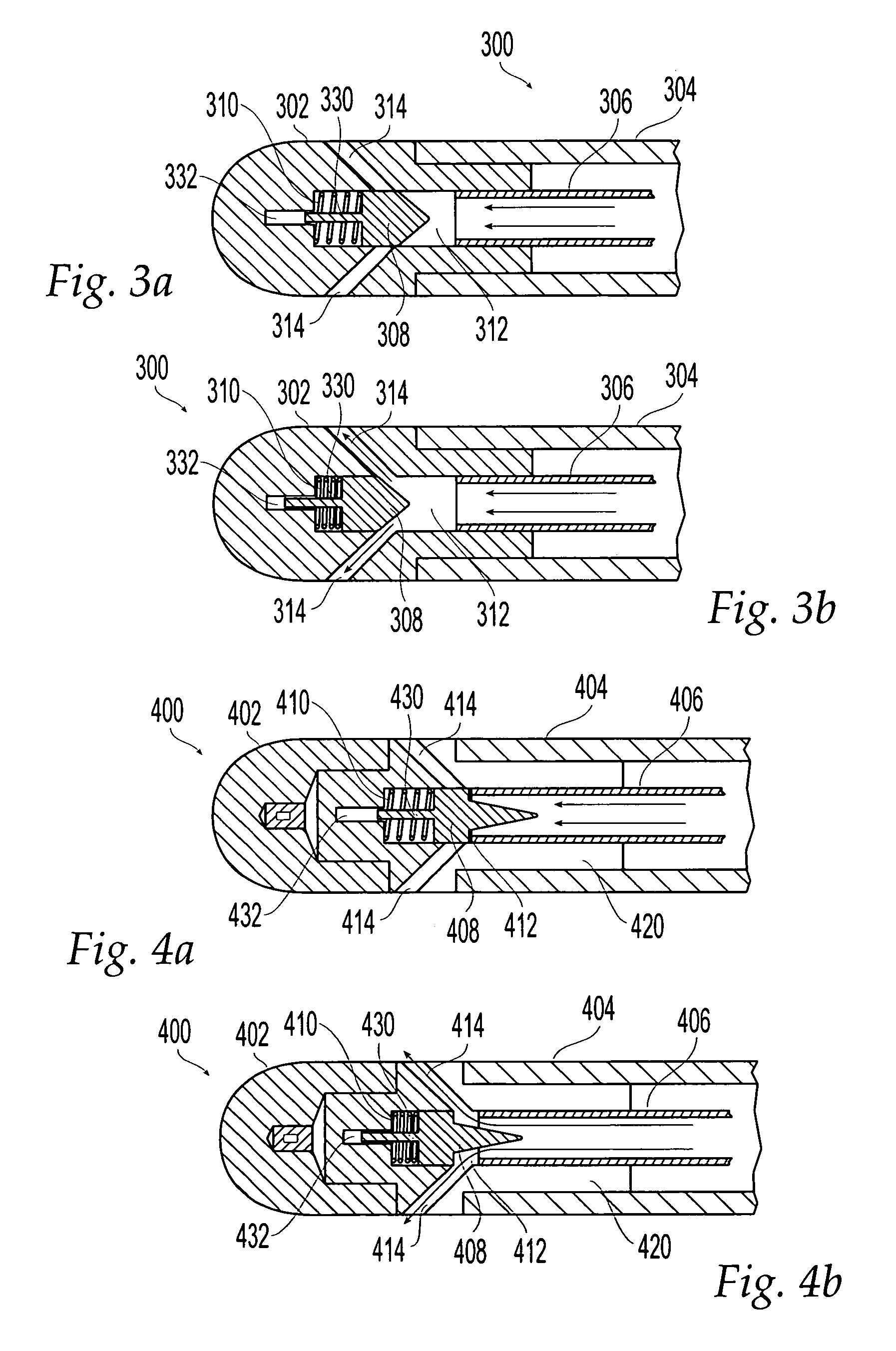 Irrigated ablation catheter having a valve to prevent backflow