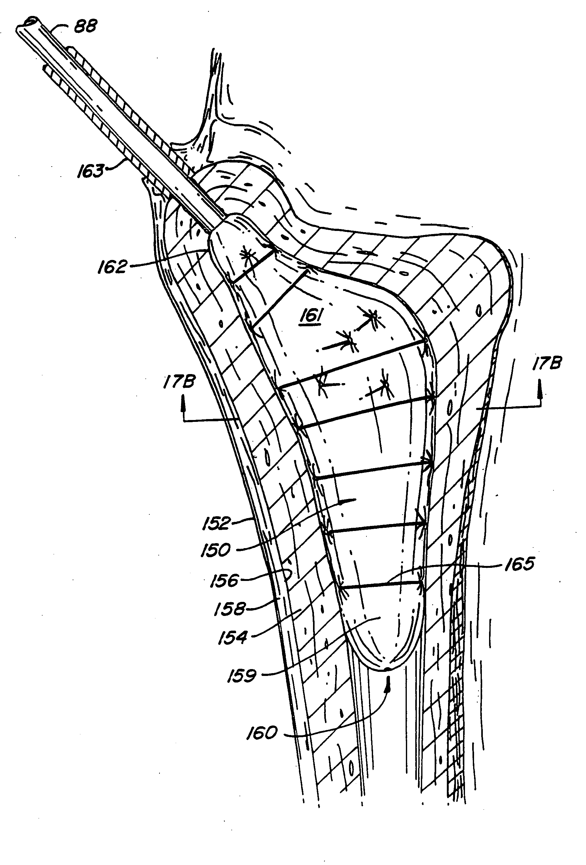 Cavity formation device