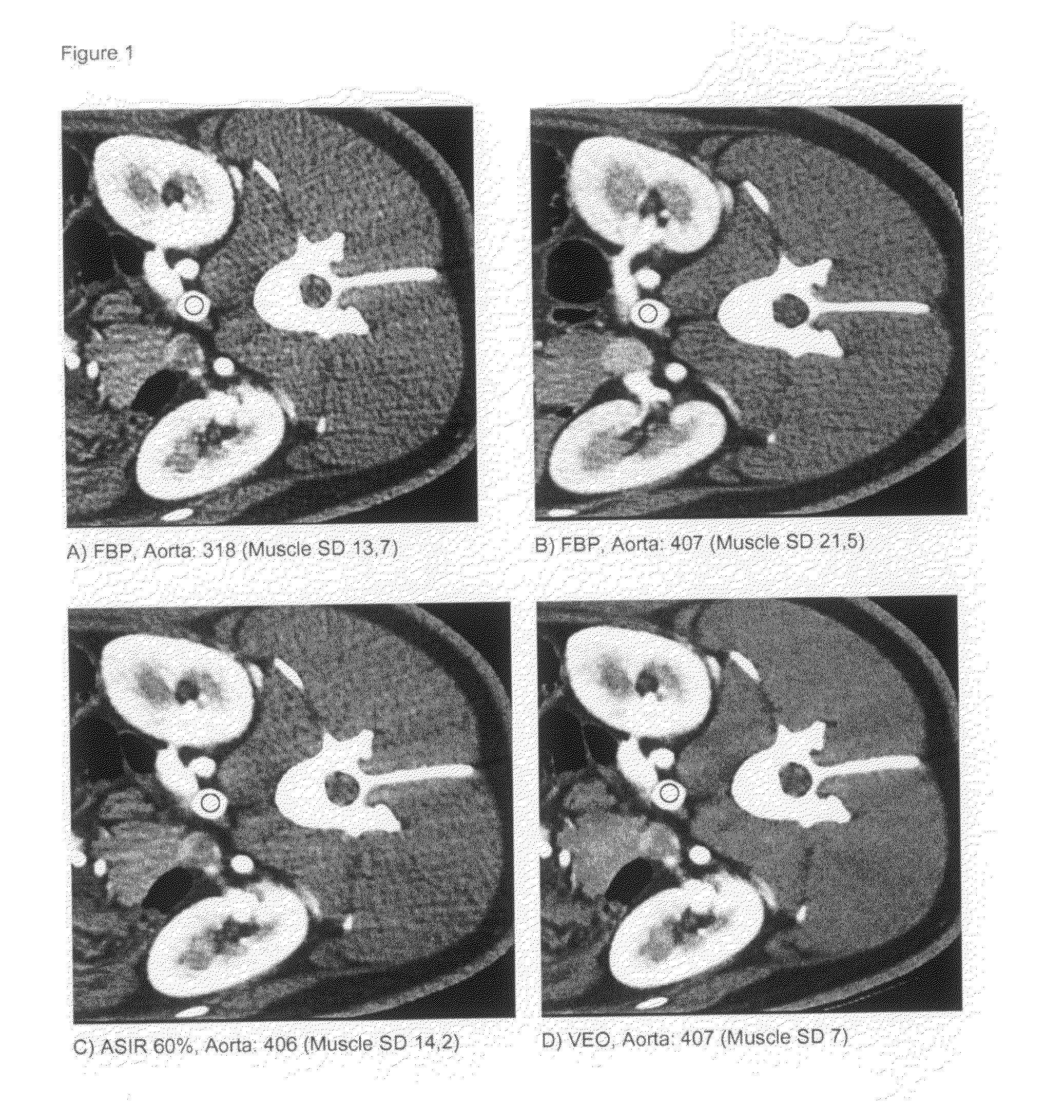 X-ray imaging contrast media with low iodine concentration and x-ray imaging process