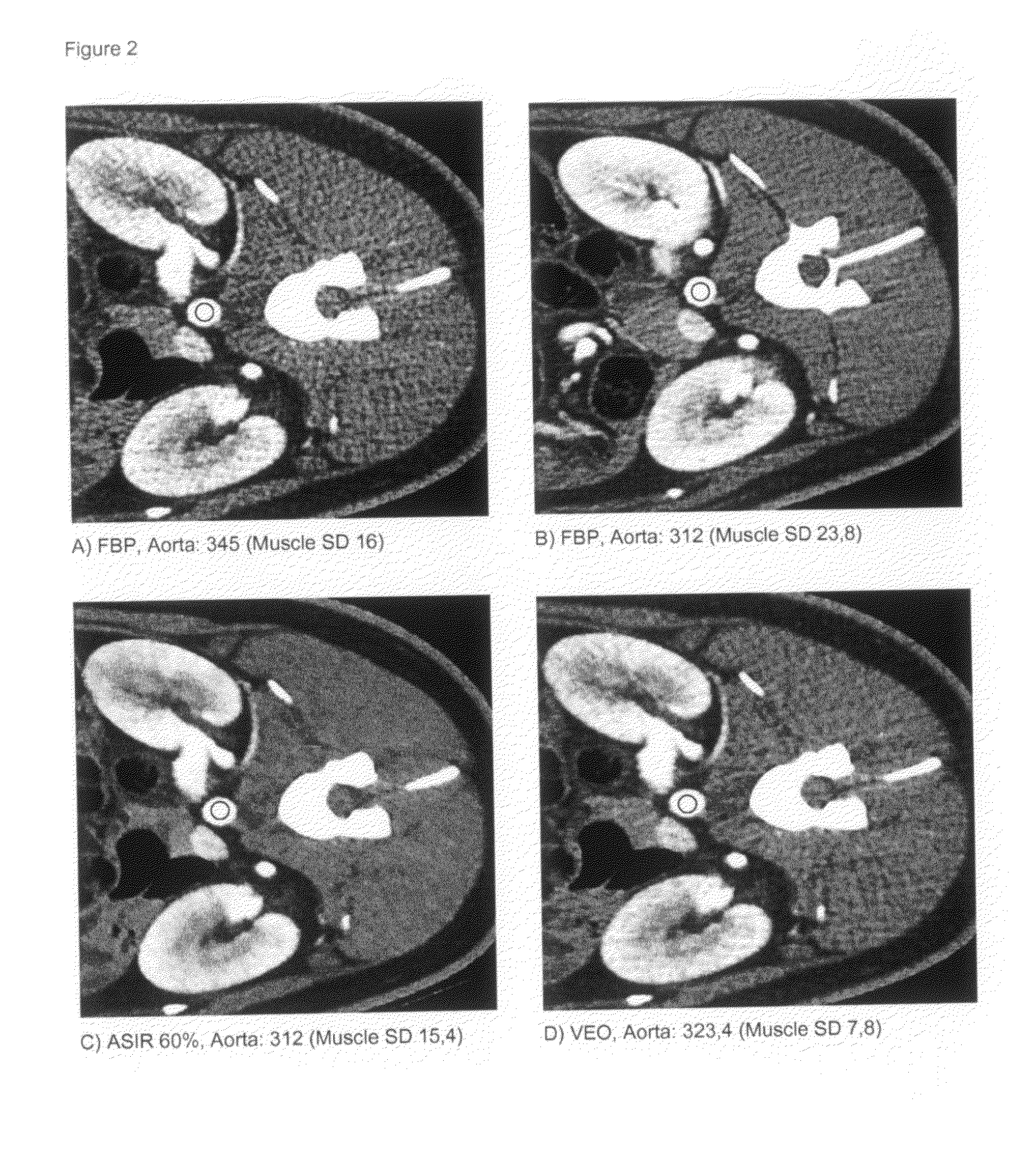 X-ray imaging contrast media with low iodine concentration and x-ray imaging process