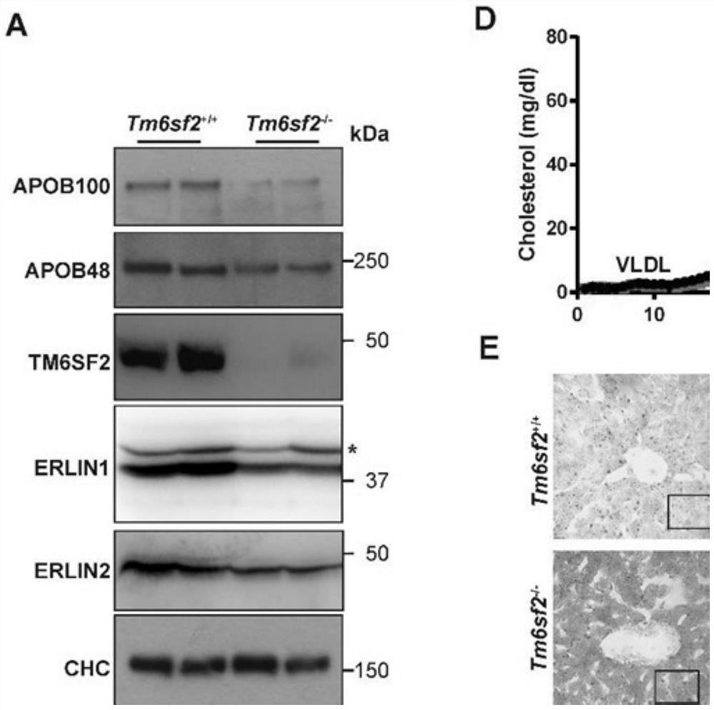 Applications of transmembrane protein, endoplasmic reticulum liporaft proteins or antagonists or inhibitors of coding genes thereof