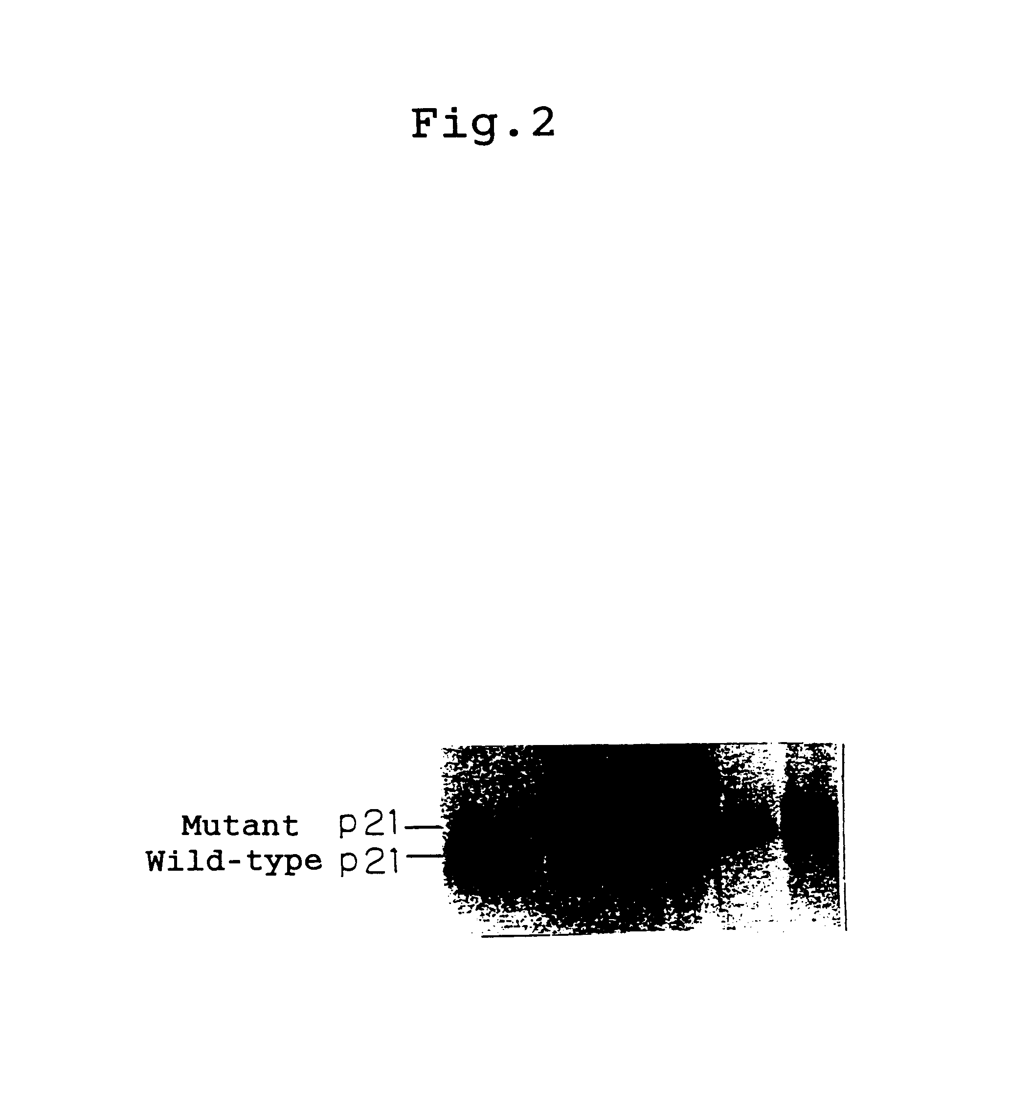 Tumor cells having tumorigenic potential but lacking invasive/metastatic potential, method for preparing them and screening method for metastasis-related genes using the same