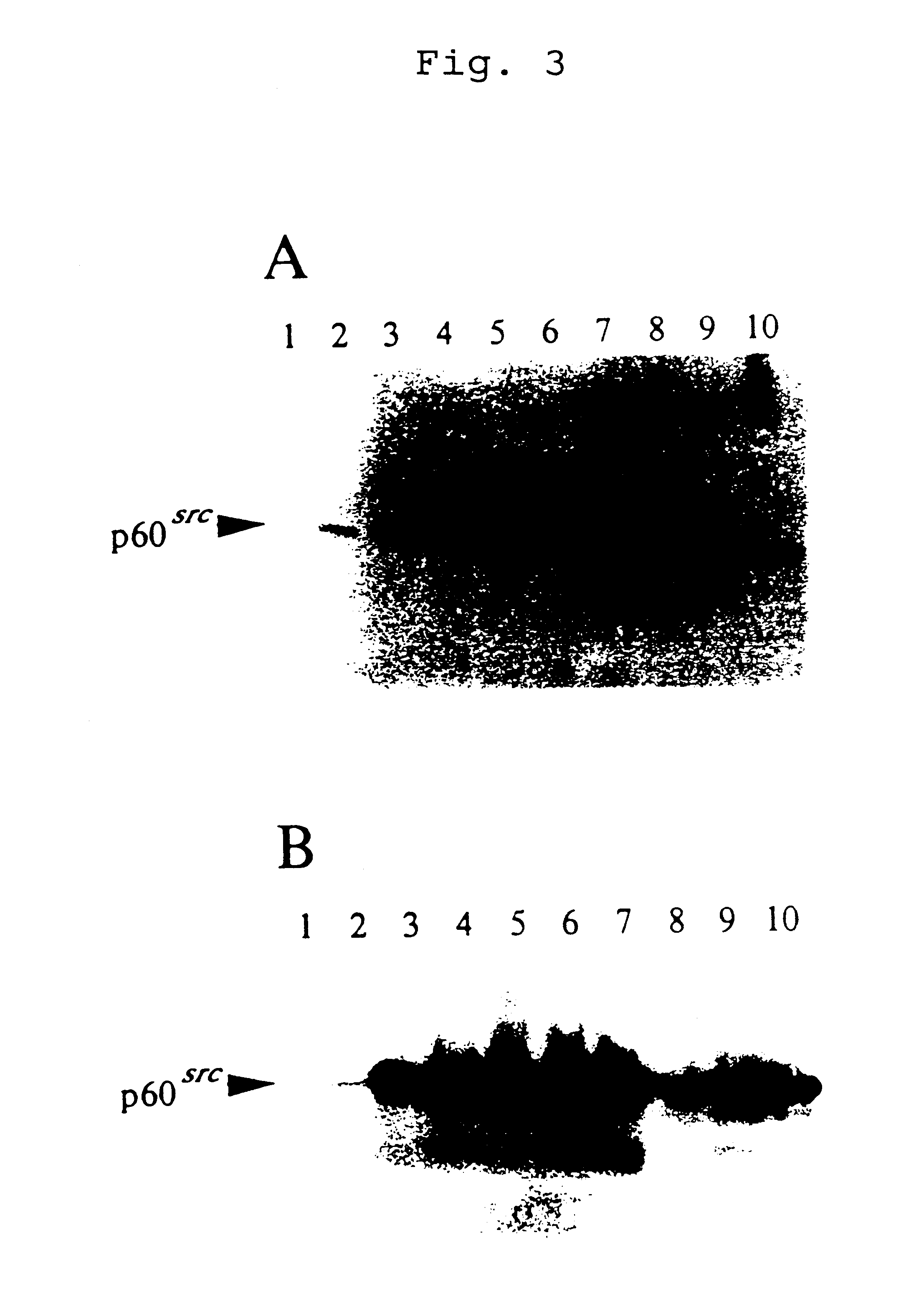 Tumor cells having tumorigenic potential but lacking invasive/metastatic potential, method for preparing them and screening method for metastasis-related genes using the same