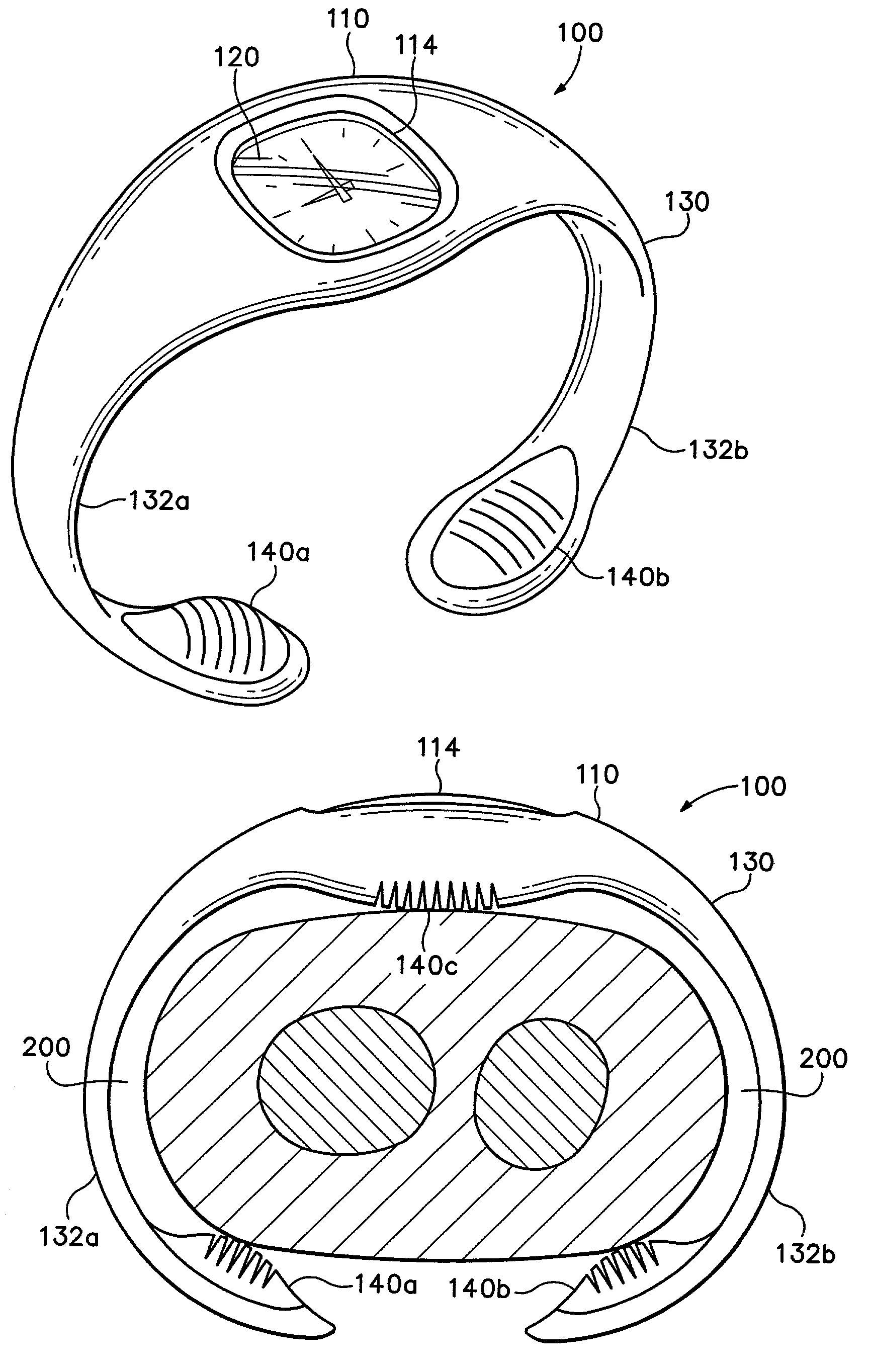 Timepiece with integral molded wristband