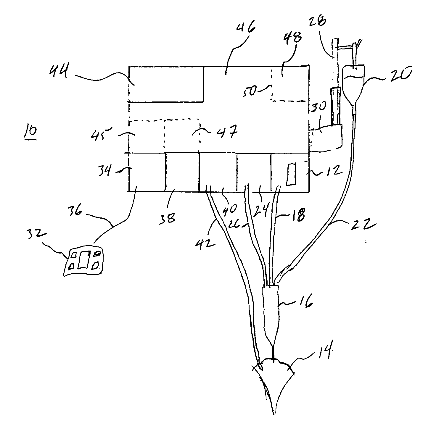 Guided and filtered user interface for use with an ophthalmic surgical system