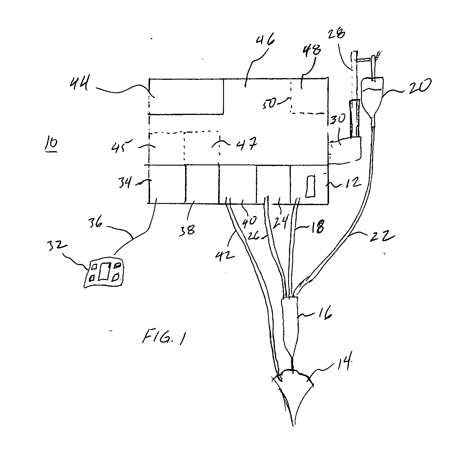 Guided and filtered user interface for use with an ophthalmic surgical system