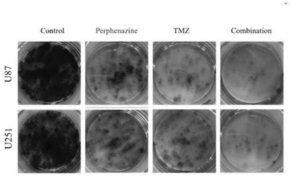 Combined medication mode for synergistically treating human brain glioma