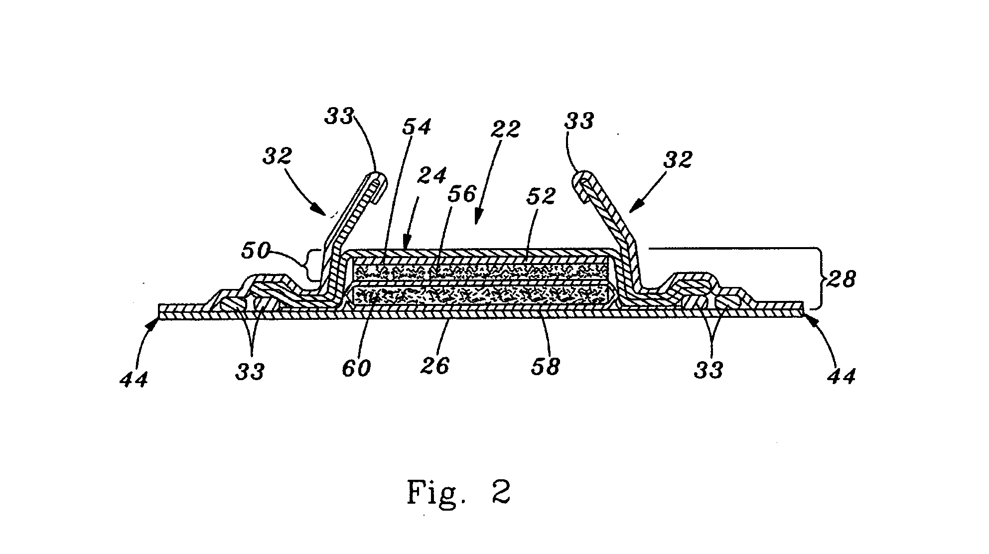 Flexible absorbent article with improved body fit