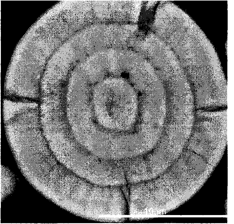 Multicomponent material with multilayer coating structure for lithium ion battery and preparation method thereof