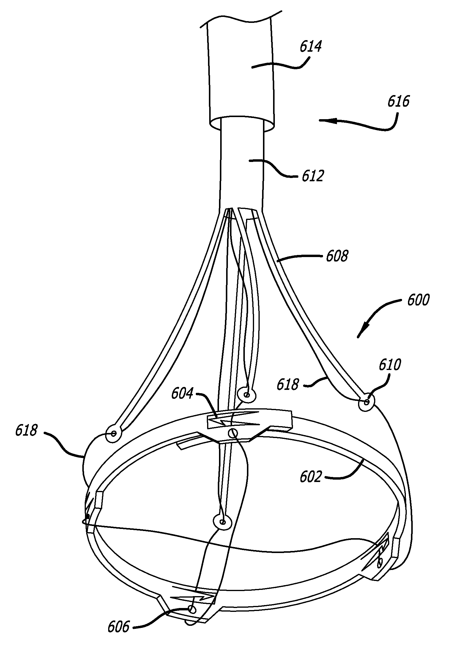 Electrical Conduction Block Implant Device