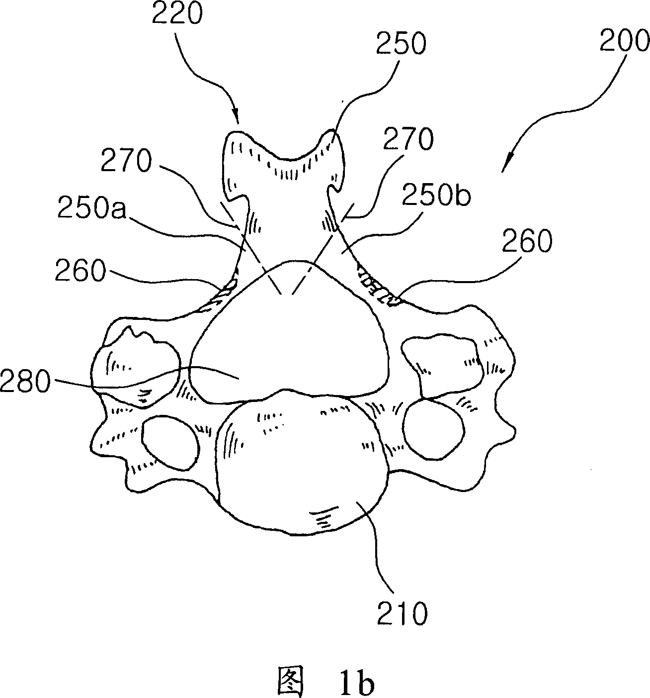 Vertebral arch positioning stent for cervical vertebra spinal canal enlargement operation