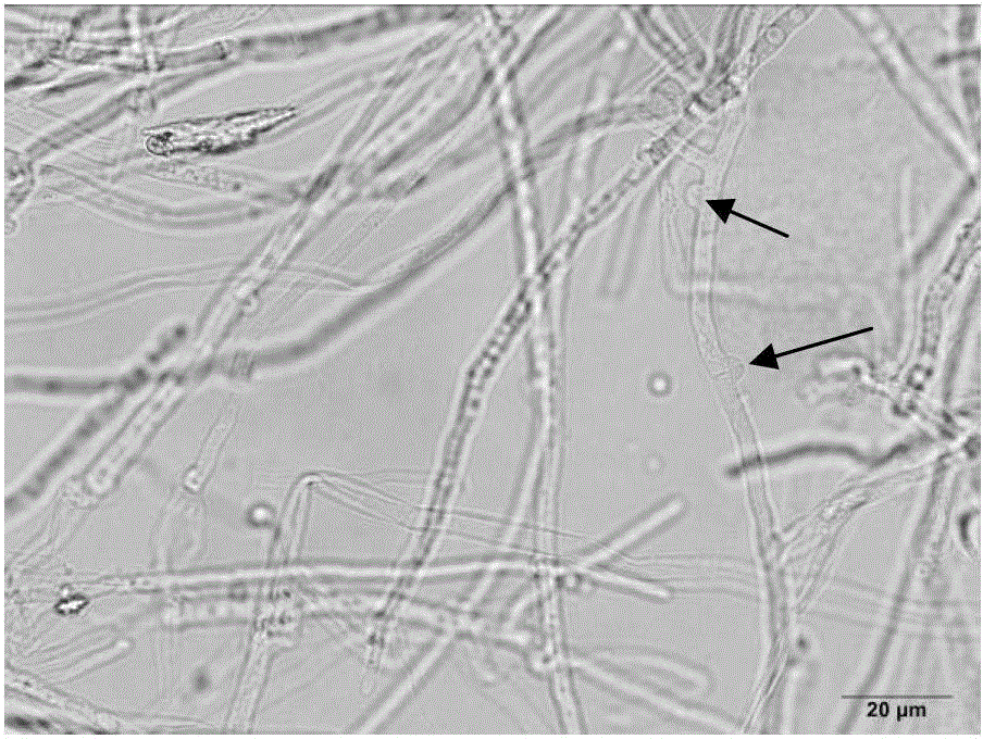 Method for identifying mating types of Lepista sordida protoplast monokaryons and special primer pair SR-1*10 therefor