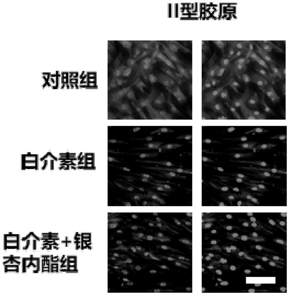 Ginkgo biloba extract for treating osteoarthritis