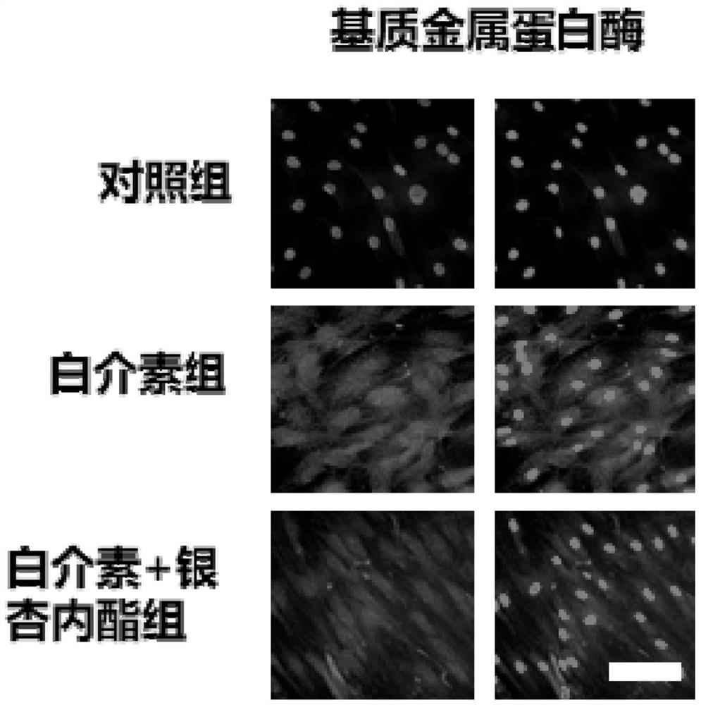 Ginkgo biloba extract for treating osteoarthritis